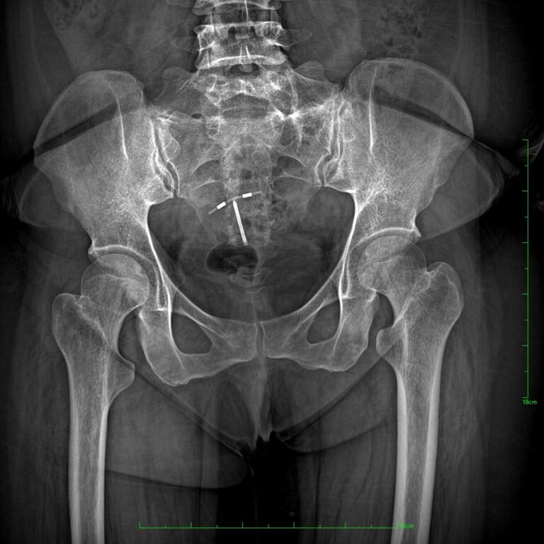 Venta de Equipos de Imagenología Médica | Rayos X, Mamógrafos, Tomógrafos y Más