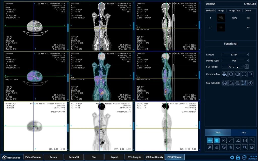 petct